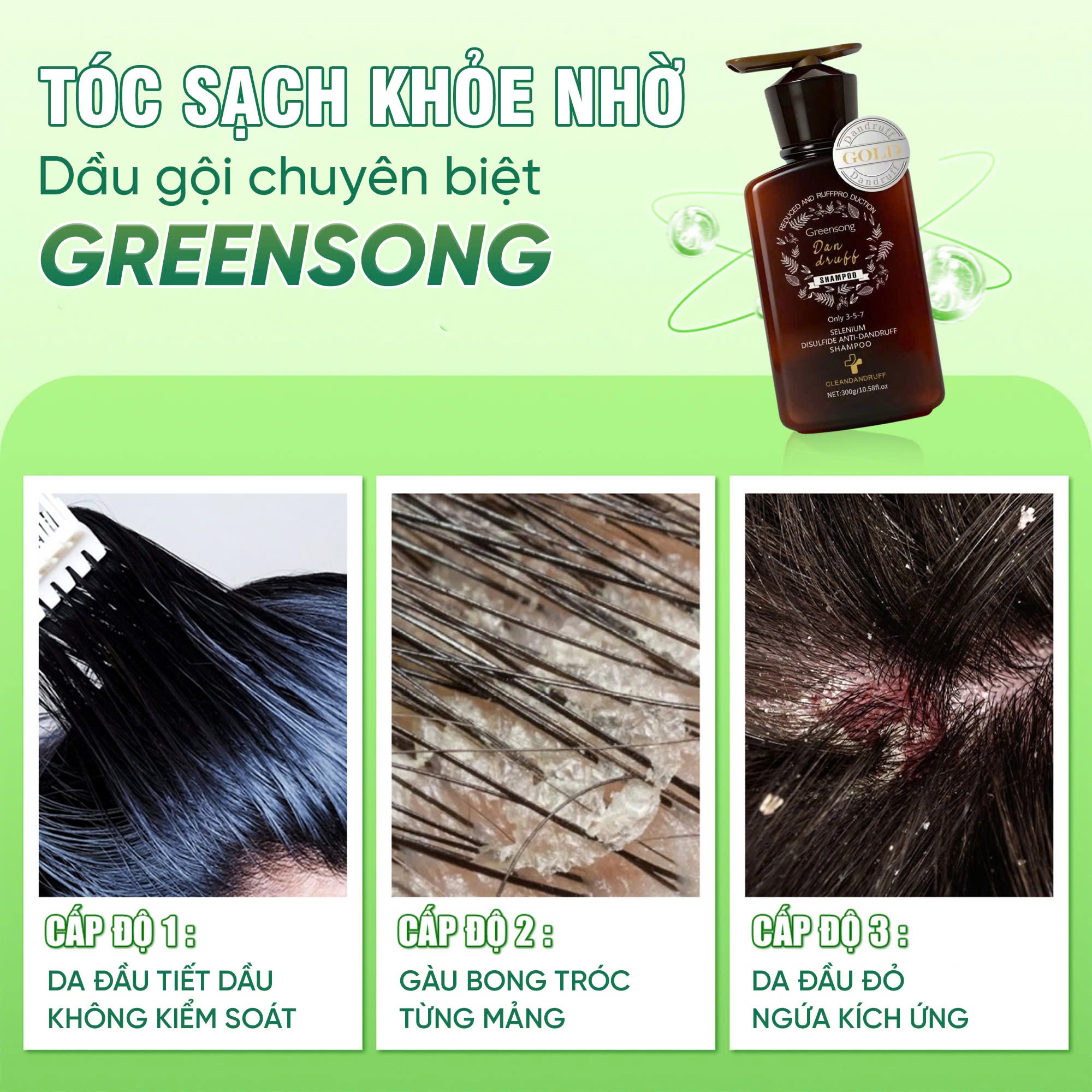Dau-goi-chuyen-biet-greensong-thach-thuc-gau-ngua-3-cap-do
