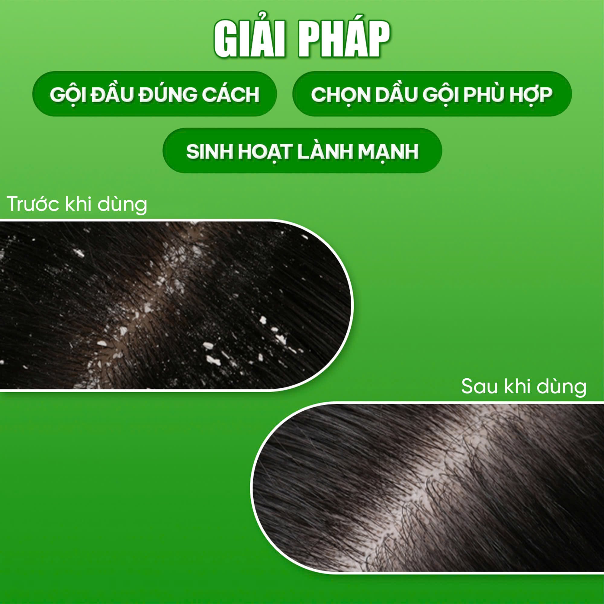 Truoc-va-sau-khi-su-dung-san-pham-cho-hieu-qua-cai-thien-ro-ret